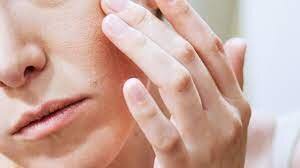 نکاتی برای تشخیص و درمان خانگی اگزمای صورت