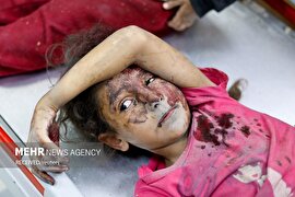 تصاویر| کودکان بستری در بیمارستان‌های غزه