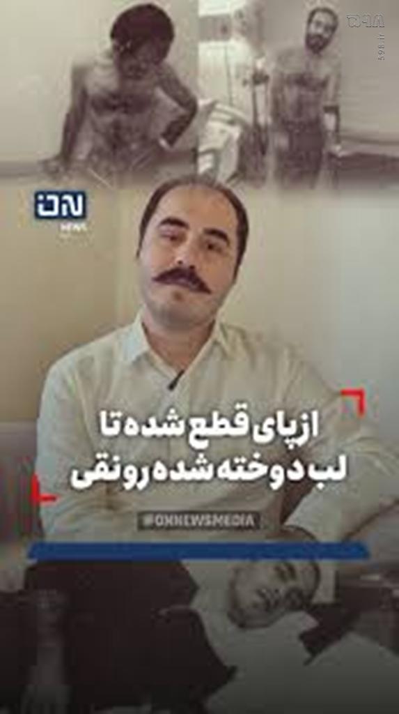 شارلاتان‌بازی حسین رونقی: شکستگی‌های خیالی، اعتصاب‌های چاق‌کننده و لب‌های دوخته برای لایک!