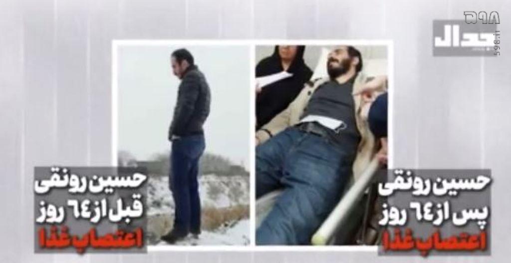 شارلاتان‌بازی حسین رونقی: شکستگی‌های خیالی، اعتصاب‌های چاق‌کننده و لب‌های دوخته برای لایک!